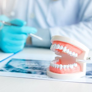 Model teeth on an x-ray on a desk with a dentist in blue gloves blurry in the background