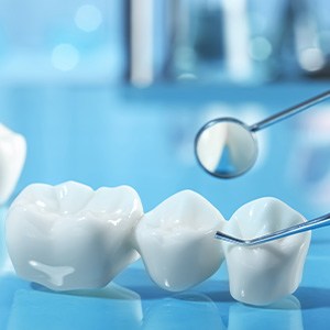 Dental implant and bridge on a reflective blue surface next to a mirror